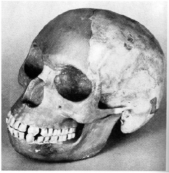 Piltdown Man